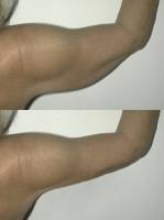 Notre zone d'activité pour ce service Lifting pour les jeunes femmes : des résultats naturels avec le Docteur Alain Fogli